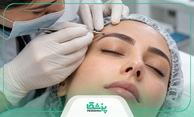 مراقبتهای بعد از کاشت ابرو چیست؟