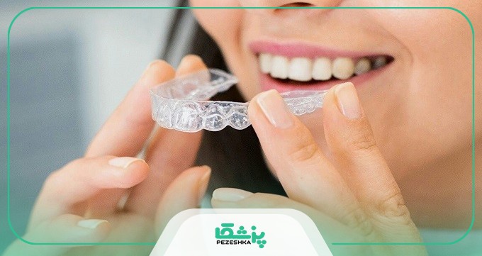هزینه تقریبی خدمات بهترین دکتر متخصص ارتودنسی تهران