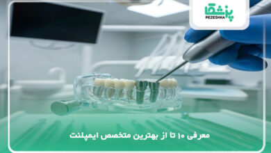 بهترین متخصص ایمپلنت