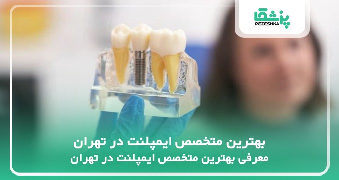 بهترین متخصص ایمپلنت در تهران