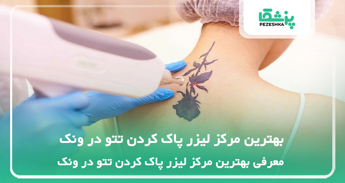 بهترین مرکز لیزر پاک کردن تتو در ونک