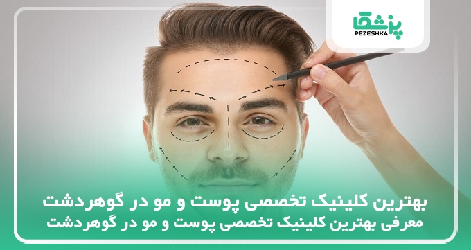 بهترین کلینیک‌ تخصصی پوست و مو در گوهردشت