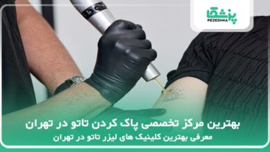 The best specialized tattoo removal center in Tehran