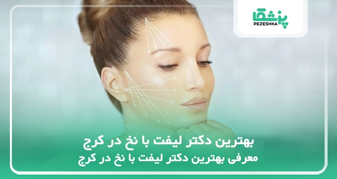 بهترین دکتر لیفت با نخ در کرج