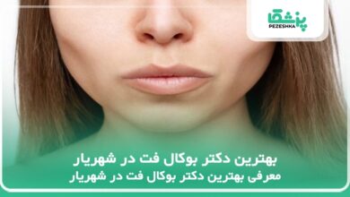 بهترین دکتر بوکال فت در شهریار
