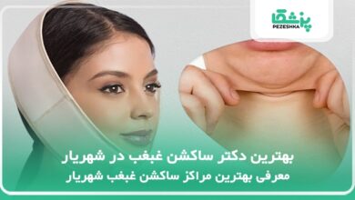 بهترین دکتر ساکشن غبغب در شهریار