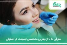 بهترین متخصص ایمپلنت در اصفهان