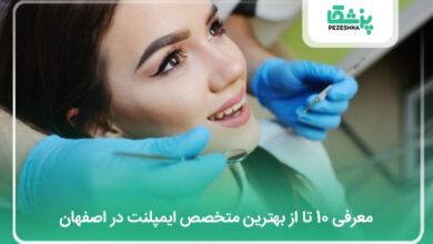 بهترین متخصص ایمپلنت در اصفهان