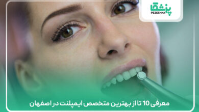 معرفی 10 تا از بهترین متخصص ایمپلنت در اصفهان