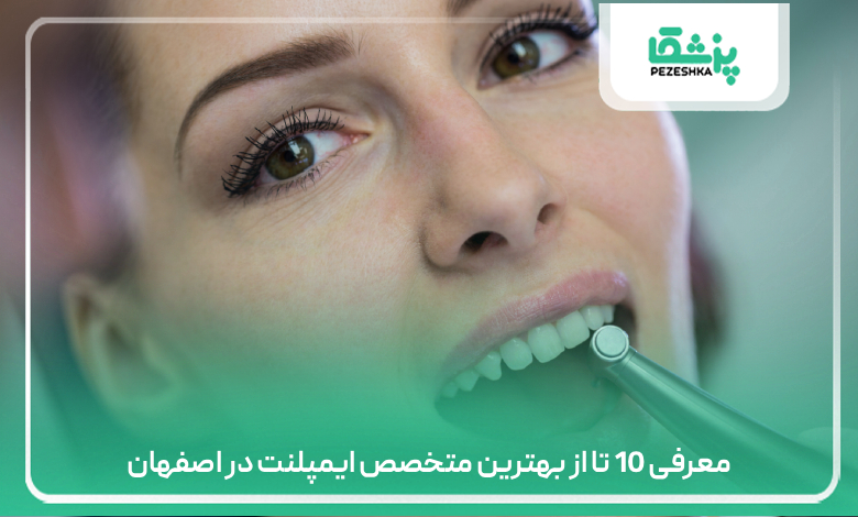 معرفی 10 تا از بهترین متخصص ایمپلنت در اصفهان