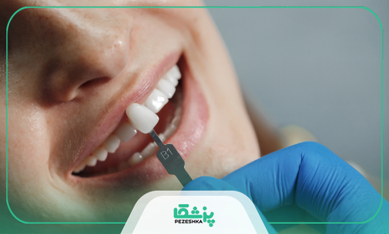 بهترین برند ایمپلنت دندان کدام است؟