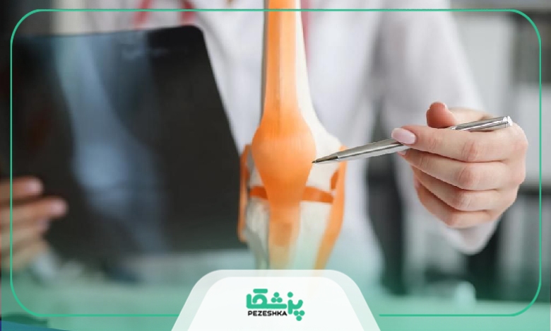 برای پیشگیری از آرتروز زانو چه باید کرد؟