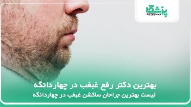 بهترین دکتر رفع غبغب در چهاردانگه
