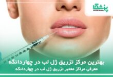 بهترین مرکز تزریق ژل لب در چهاردانگه