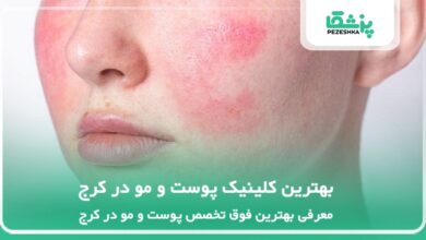 بهترین کلینیک پوست و مو در کرج