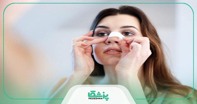 هفته اول بعد از جراحی بینی