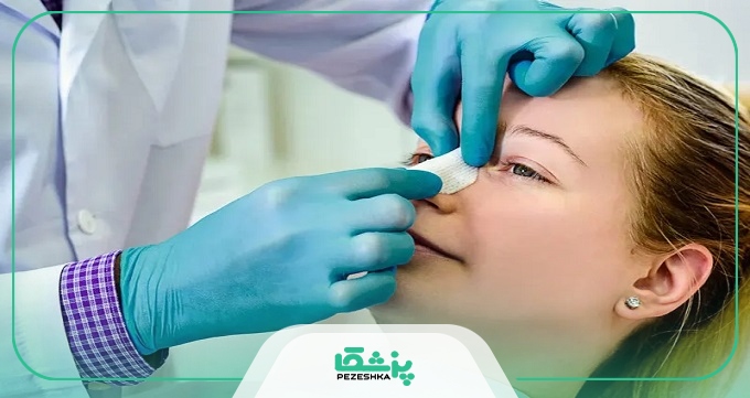 مراقبت ‌های بعد از جراحی بینی در هفته اول