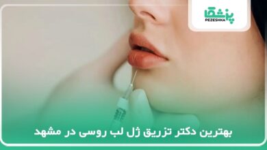 بهترین دکتر تزریق ژل لب روسی در مشهد