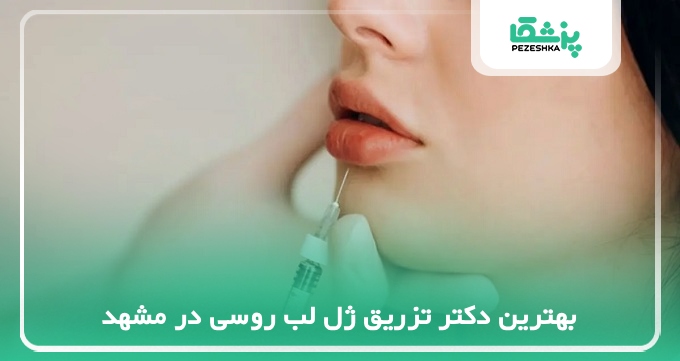 بهترین دکتر تزریق ژل لب روسی در مشهد