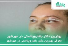 بهترین دکتر بلفاروپلاستی در مهرشهر