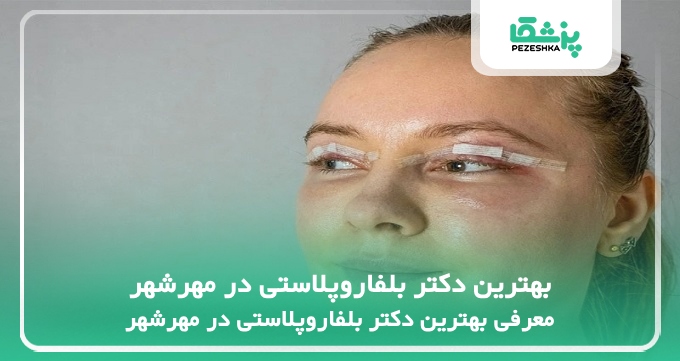 بهترین دکتر بلفاروپلاستی در مهرشهر