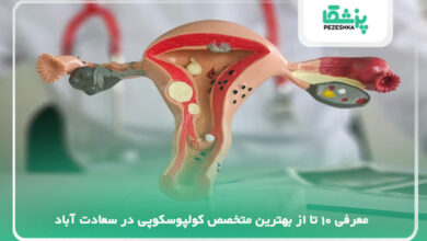 بهترین متخصص کولپوسکوپی در سعادت آباد