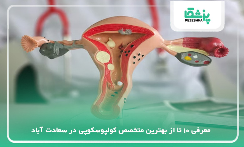 بهترین متخصص کولپوسکوپی در سعادت آباد