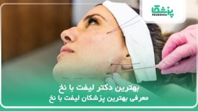 بهترین دکتر لیفت با نخ