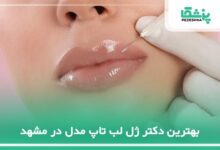 بهترین دکتر ژل لب تاپ مدل در مشهد