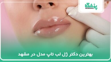 بهترین دکتر ژل لب تاپ مدل در مشهد