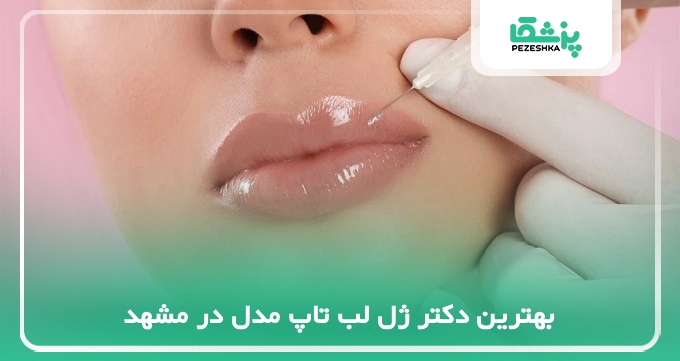 بهترین دکتر ژل لب تاپ مدل در مشهد