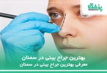 بهترین جراح بینی در سمنان