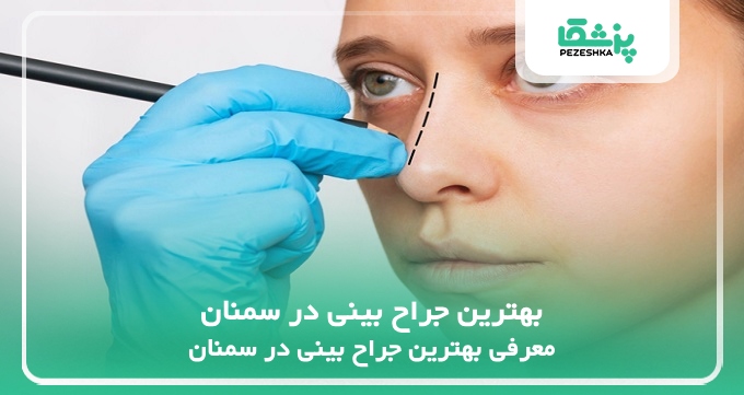 بهترین جراح بینی در سمنان