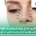 10 تا از بهترین جراح بینی ترمیمی در تهران❤️【سال1404】⭐