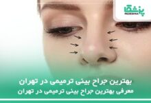 بهترین جراح بینی ترمیمی در تهران
