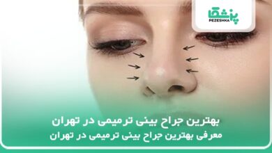 بهترین جراح بینی ترمیمی در تهران