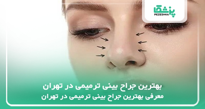 بهترین جراح بینی ترمیمی در تهران