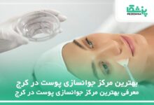 بهترین مرکز جوانسازی پوست در کرج