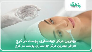 بهترین مرکز جوانسازی پوست در کرج
