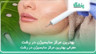 بهترین مرکز سابسیژن در رشت