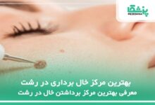 بهترین مرکز خال برداری در رشت