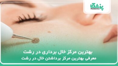 بهترین مرکز خال برداری در رشت