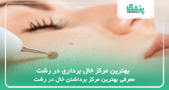 بهترین مرکز خال برداری در رشت