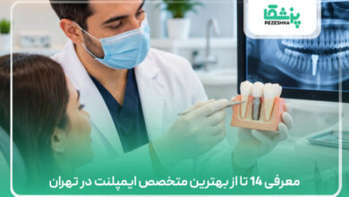 معرفی 14 تا از بهترین متخصص ایمپلنت در تهران