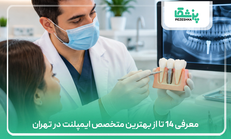 معرفی 14 تا از بهترین متخصص ایمپلنت در تهران