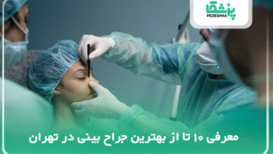 معرفی 10 تا از بهترین جراح بینی در تهران