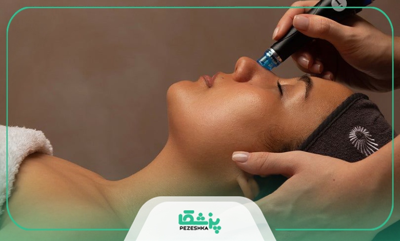 چگونه بهترین دکتر فیشیال در ایران انتخاب کنیم؟