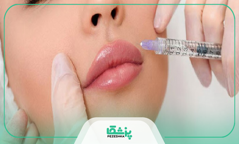 مزایا و معایب تزریق ژل از نظر دکتر تزریق ژل در مشهد