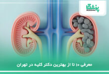 بهترین دکتر کلیه در تهران