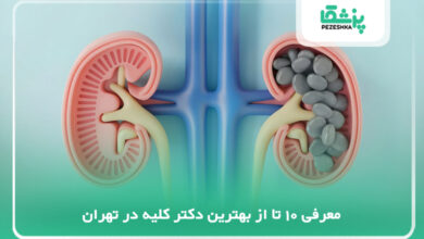 بهترین دکتر کلیه در تهران